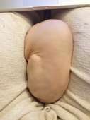187