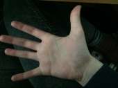 37