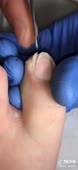 576x1248