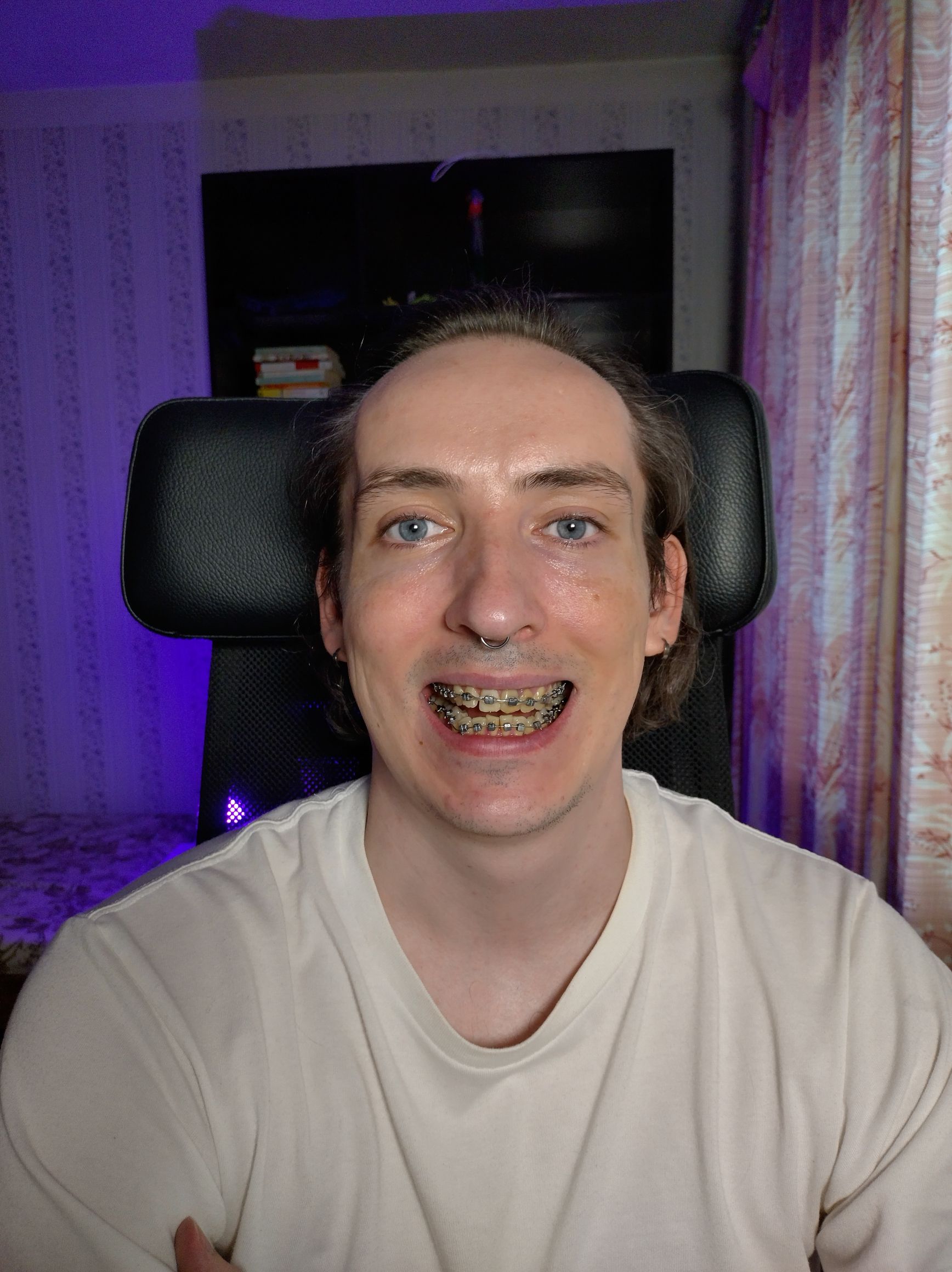 1736x2320