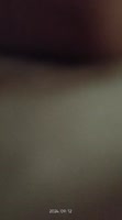 400x720