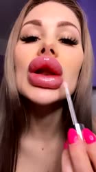 720x1280