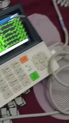 720x1280