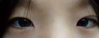 400x155